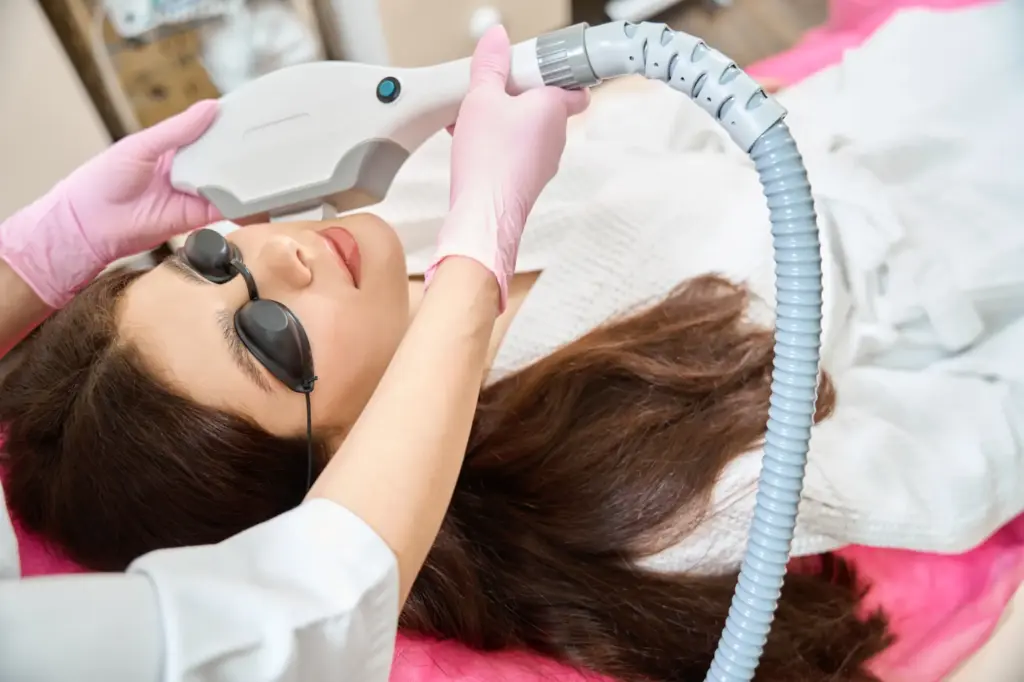 IPL photofacial