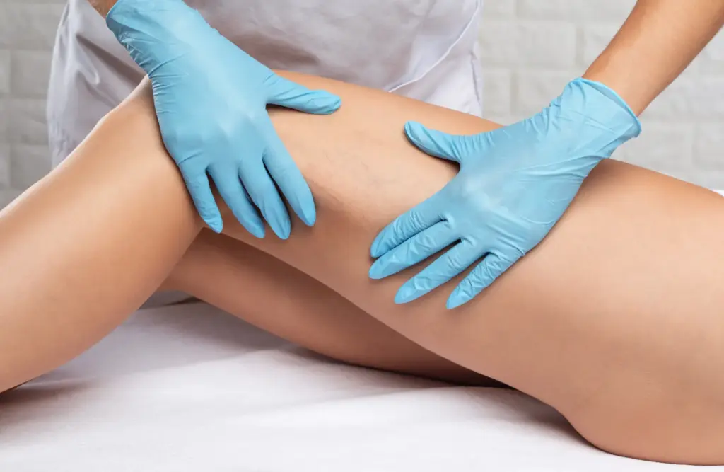 vein vascular